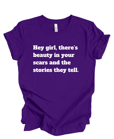 Beauty, Scars tell the story T-Shirt